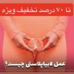 عکس قبل و بعد لابیاپلاستی نی نی سایت